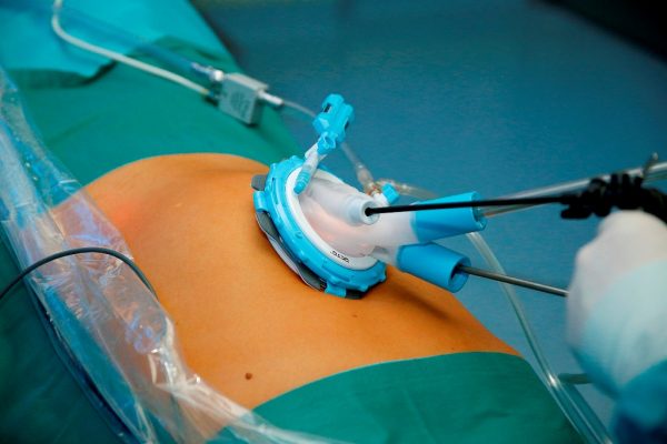 Imagebild_SILS-OP_1