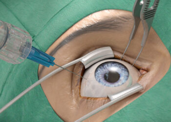 Neue Augen-Spezialambulanz im Salzkammergut Klinikum Gmunden